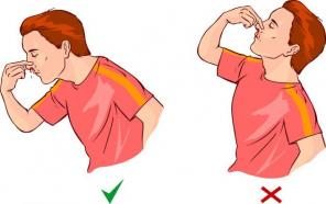 Kako prestati nosebleeds