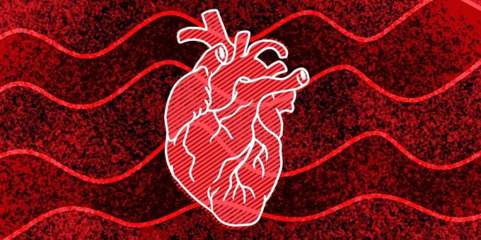 11 znakova da vam se mogu dogoditi srčani zastoj