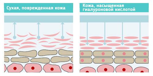Kako se hijaluronske