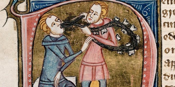 Srednjovjekovna medicina: vađenje zuba. Omne Bonum, London, 1360-1375