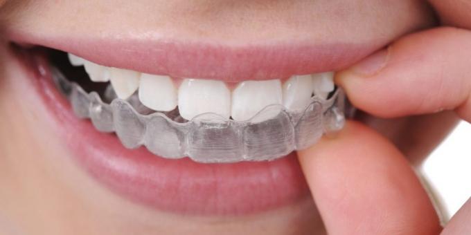 Zubi mljevenje: zaštitni poklopac
