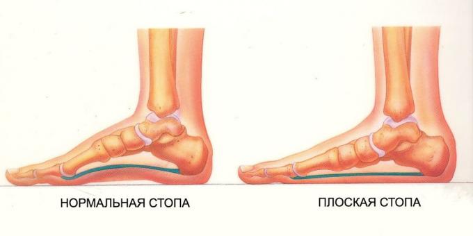 vježbe za ravne noge: normalna i ravnom nogom