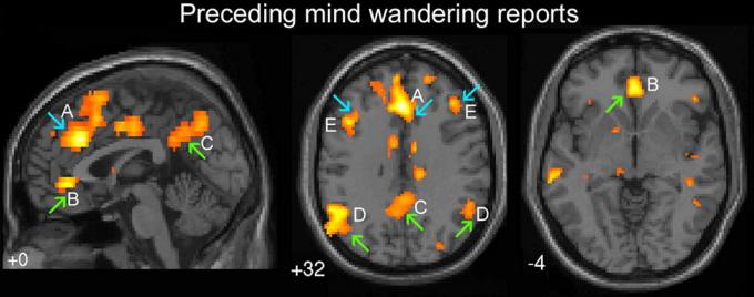 Zelene strelice ukazuju na područja u mozgu odgovoran za „automatsko ponašanje”. Plava strelica - na „izvršni” dio mozga. A - dorzalnog cingulate, B - ventralanya cingulate, C - precuneus cerebralne hemisfere, D - bilateralni temporoparietal razvodne, E - frontalnog prefrontalni korteks
