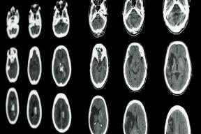 3 znanstvena potvrda amazing značajke našeg mozga