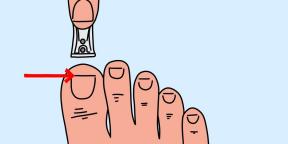 Što uzrokuje pogrešne šišanja noktiju i kako izbjeći zdravstvene probleme